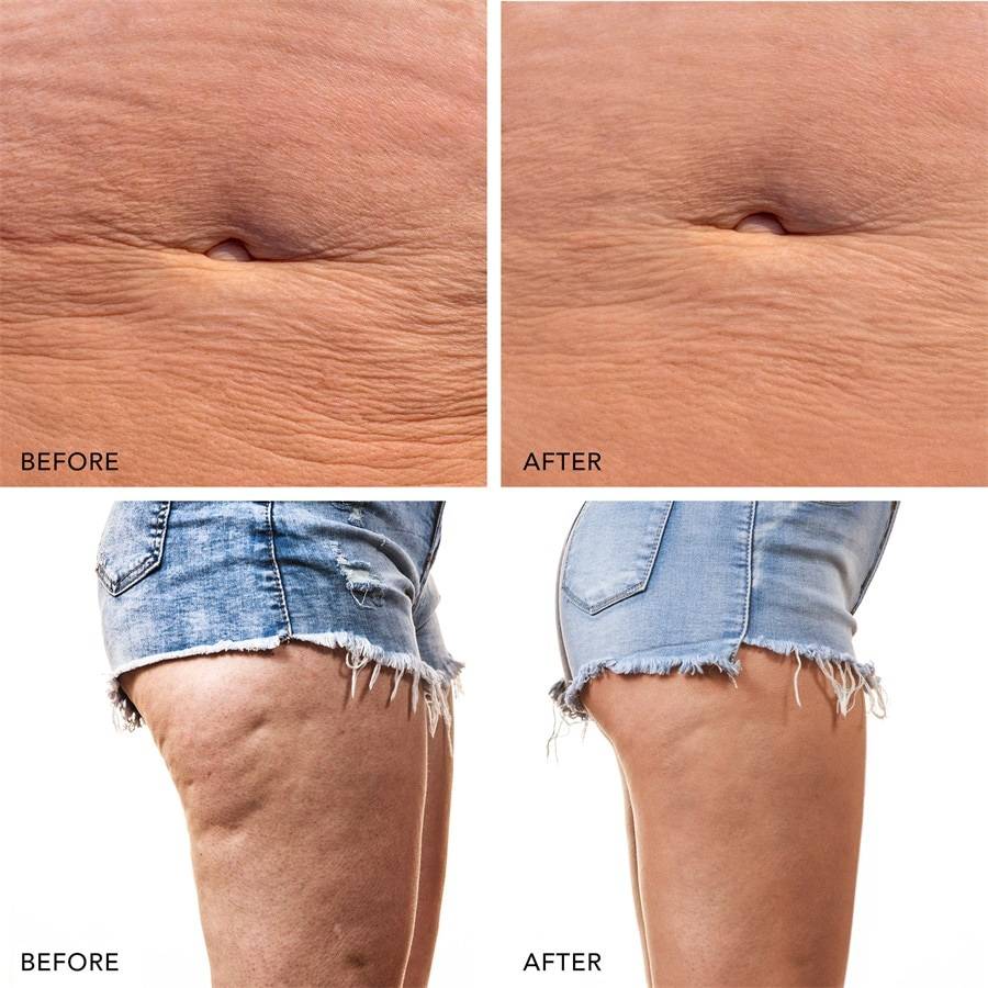Foreo Body Neueste Stile