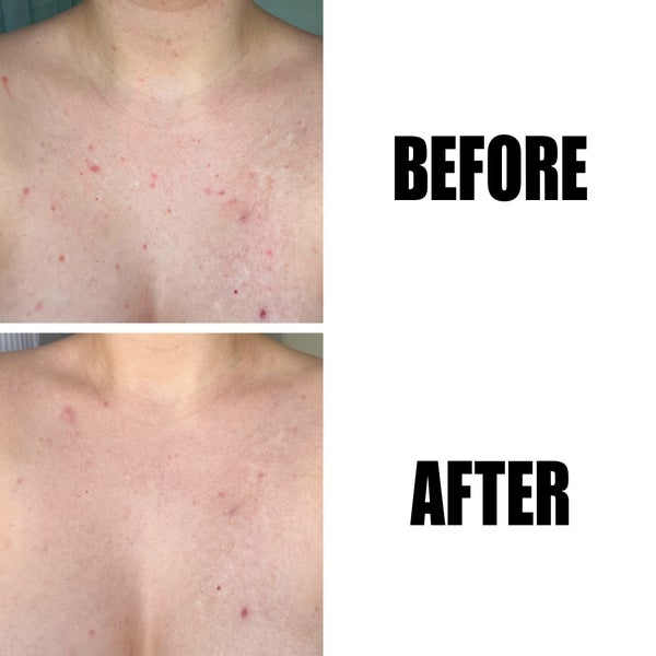 The INKEY List Glycolic Acid Exfoliating Body Stick 45g Bestseller