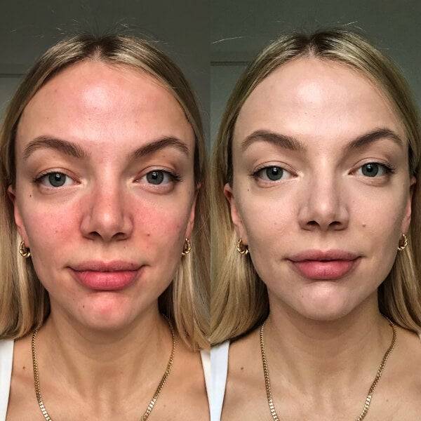 Dr.Jart+ Cicapair Tiger Grass Color Correcting Treatment 15ml Räumungsverkauf