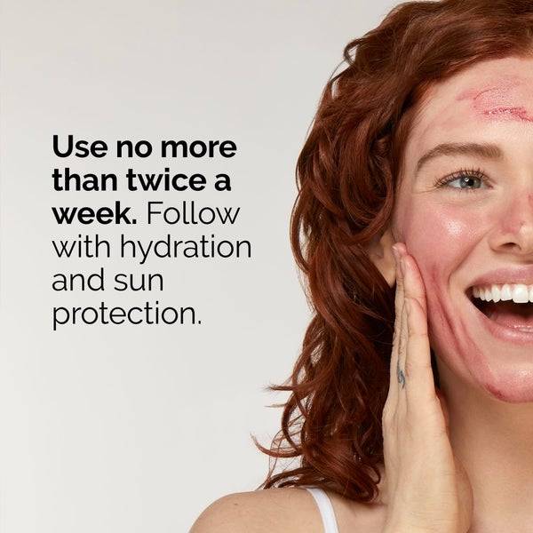The Ordinary AHA 30% + BHA 2% Peeling Solution 30ml Begrenztes Angebot