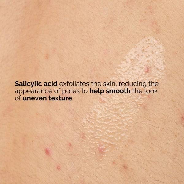 The Ordinary Salicylic Acid 0.5% Body Serum 240ml Exklusive Angebote