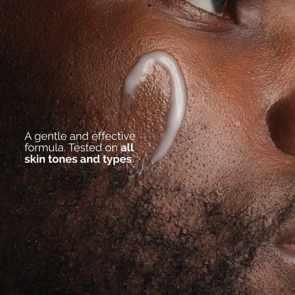 The Ordinary Niacinamide 5% Face and Body Emulsion 100ml Große Rabatte
