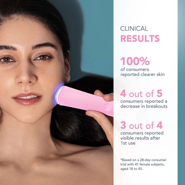 FOREO ESPADA 2 Device - Pearl Pink Letzter Tag