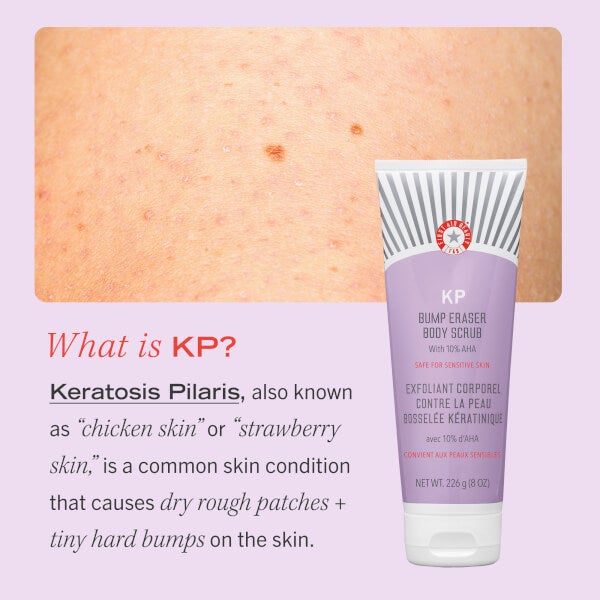 First Aid Beauty KP Bump Eraser Body Scrub with 10% AHA 226g Kostenloser Versand international