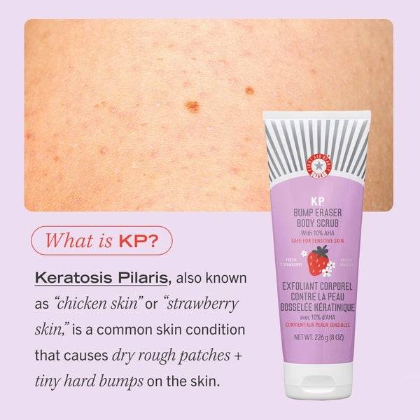First Aid Beauty KP Bump Eraser Fresh Strawberry Body Scrub with 10% AHA 226g Rabatte dieses Monats