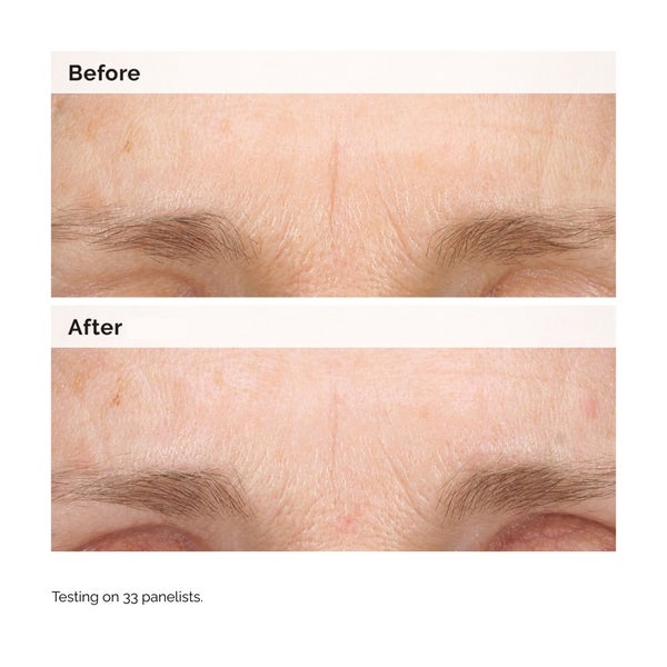The Ordinary Retinal 0.2% Emulsion 15ml Clearance-Verkauf