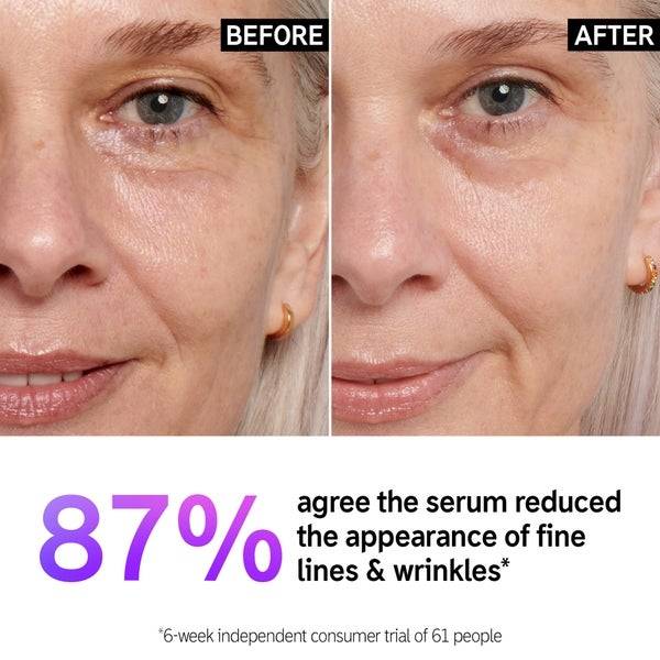 The INKEY List Retinol Serum 30ml 50% Rabatt für begrenzte Zeit