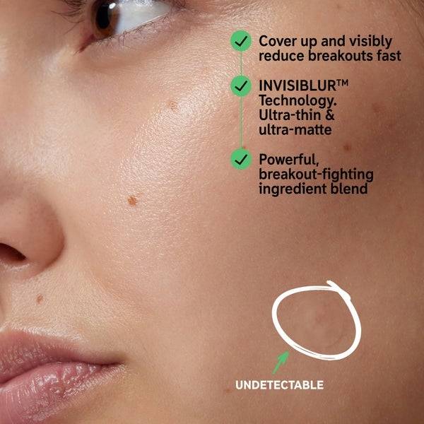 The INKEY List Hydrocolloid Invisible Pimple Patches Online