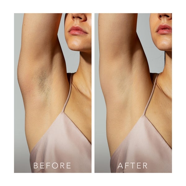 FOREO PEACH 2 Mint Riesige Ersparnisse