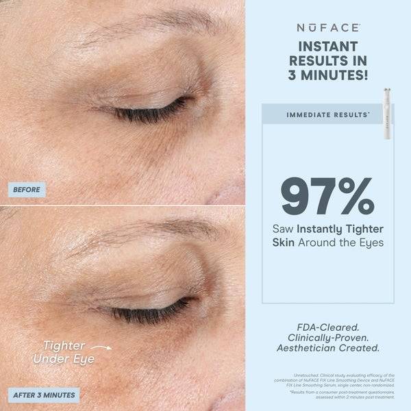 NuFACE FIX Line Smoothing Device Bis zu 60% Rabatt
