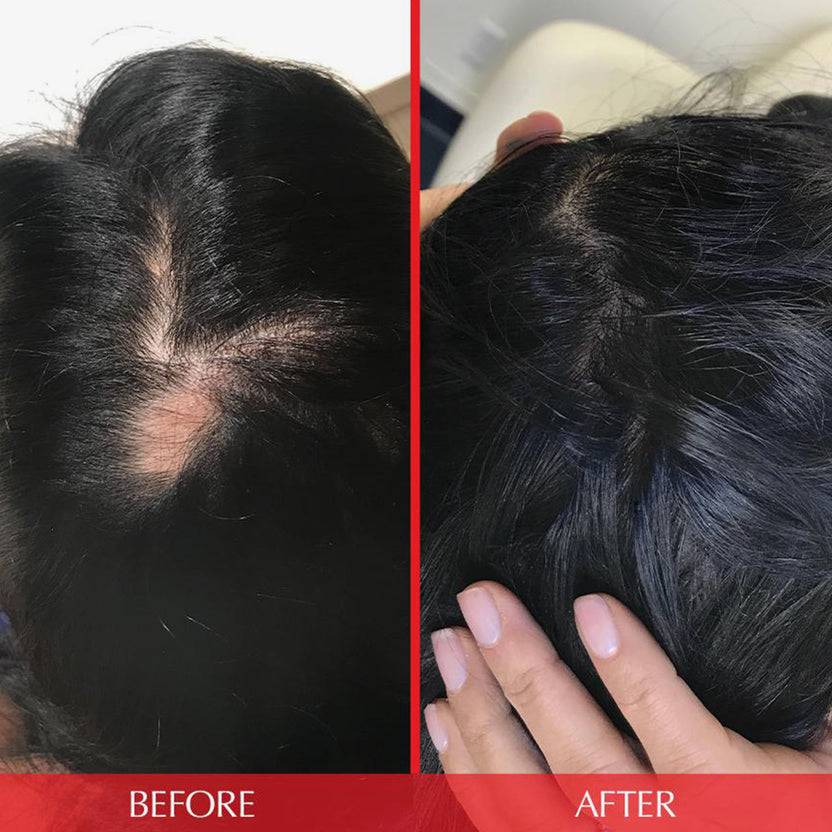 HAIRtamin HAIRtamin Advanced Formula 1 Month 50% Rabatt für begrenzte Zeit