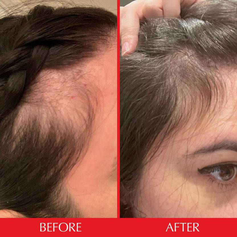 HAIRtamin Gummy Stars™ 1 Month Osterangebot