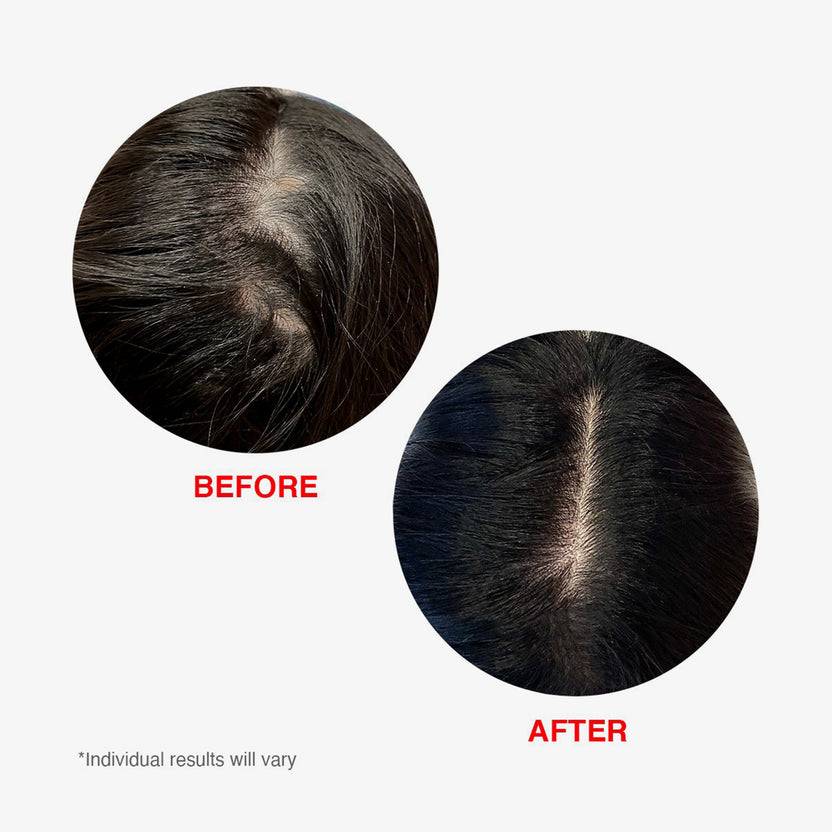 HAIRtamin Scalp Serum (60ml) Angebote
