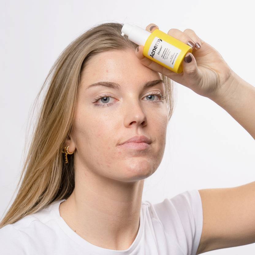 Acnemy Zitcalm Serum (30ml) JETZT KAUFEN