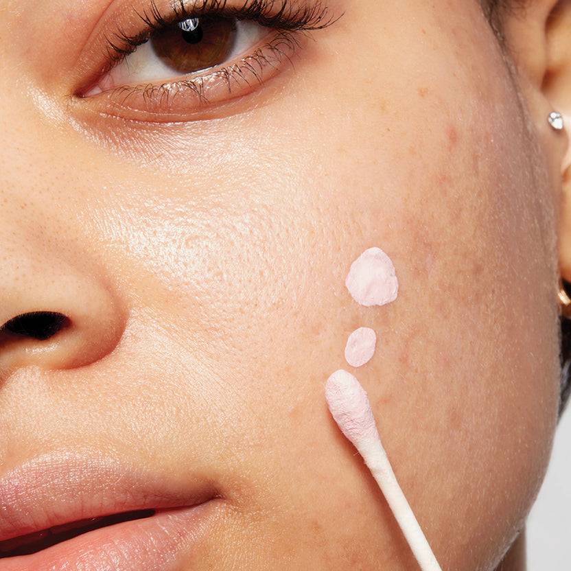 Mario Badescu Acne Control Zeitbegrenzte Promotion