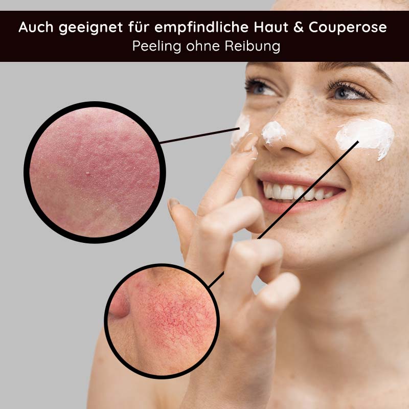 Rau Cosmetics Fruit Acid Peeling 100 ml Fruchtsäurepeeling mit BHA Tiefpreis
