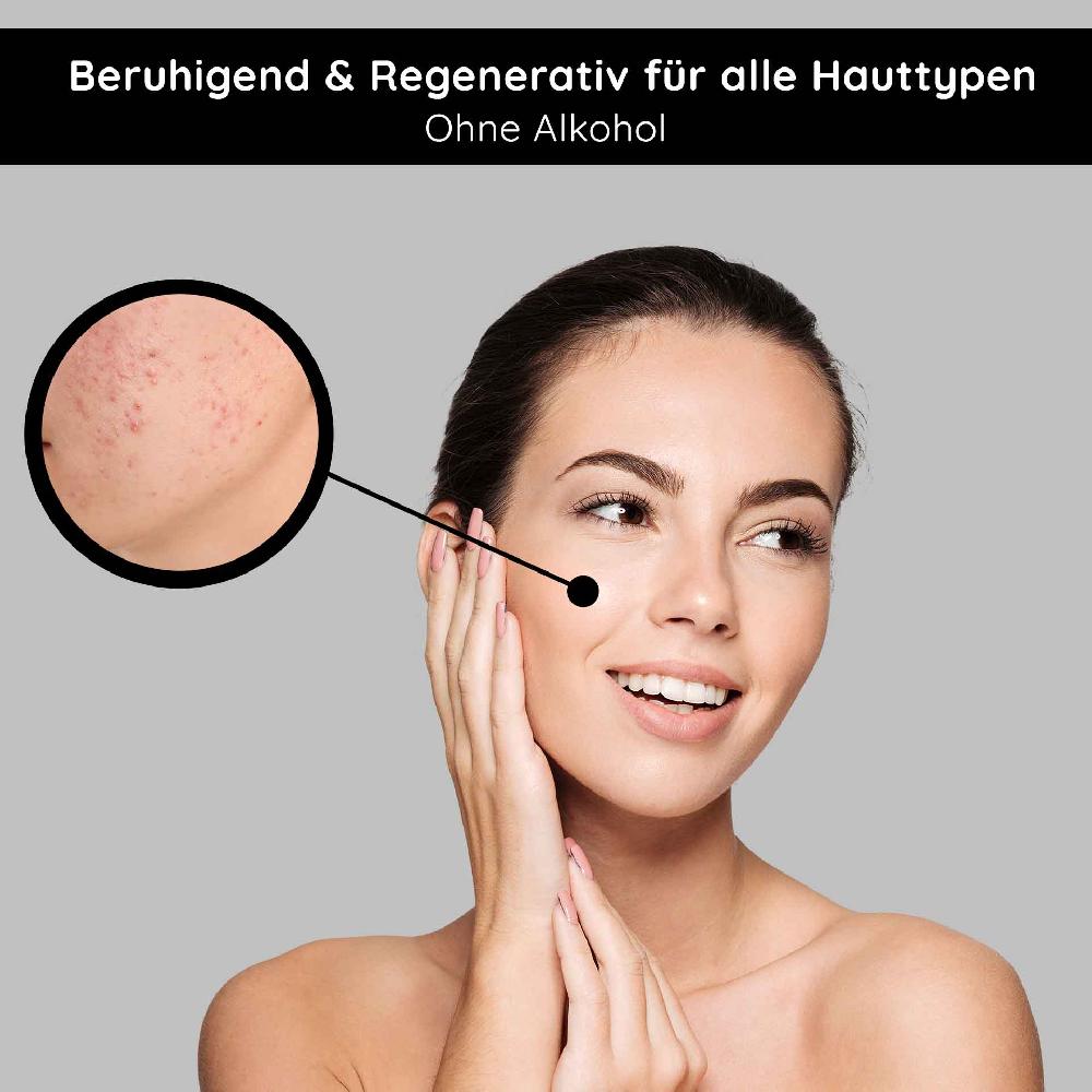 Rau Cosmetics Tonic alcohol-free 200 ml mit Brennnessel-Extrakt Begrenzte Freigabe